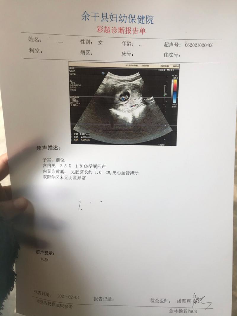 怀孕50天