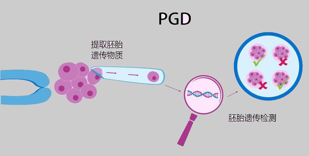 胚胎植入前遗传学诊断（PGD）