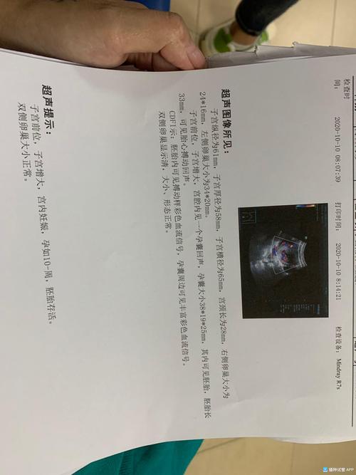 三超结果