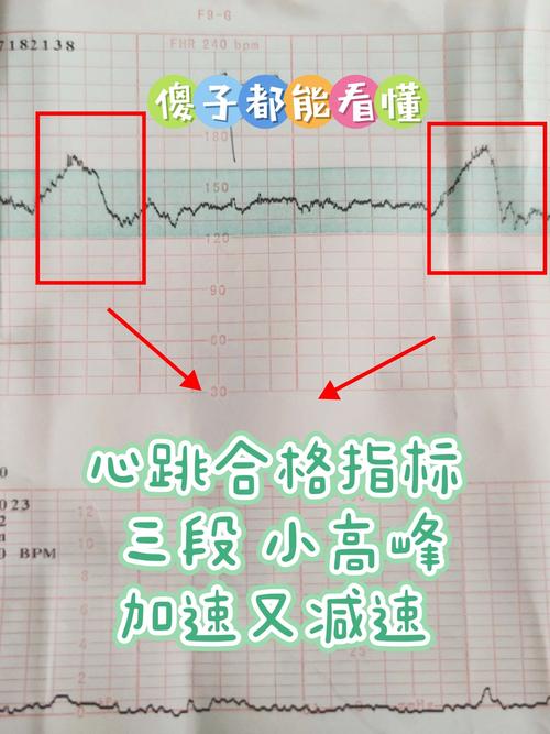 胎心增快