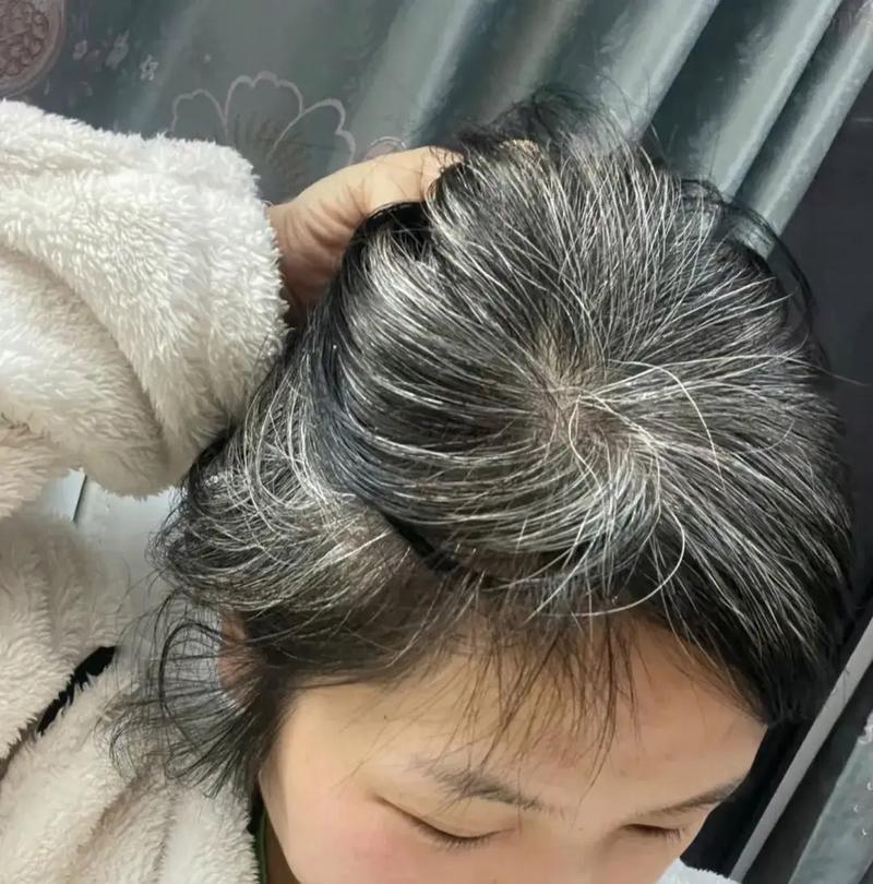 头发变白