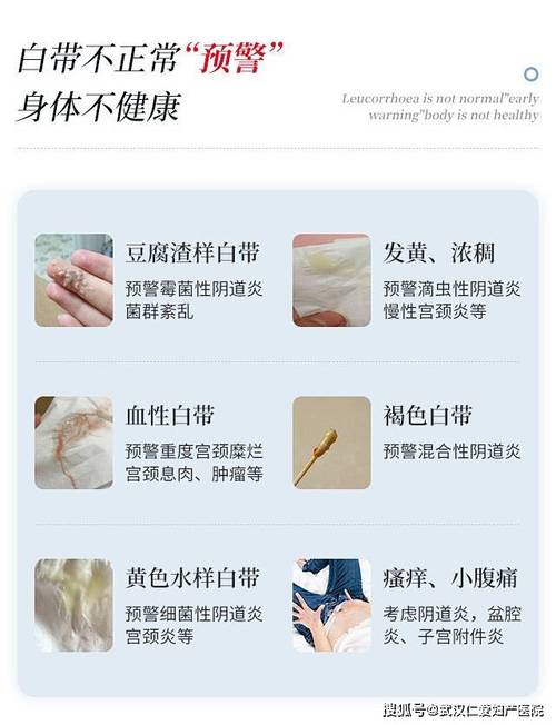 流咖啡色分泌物