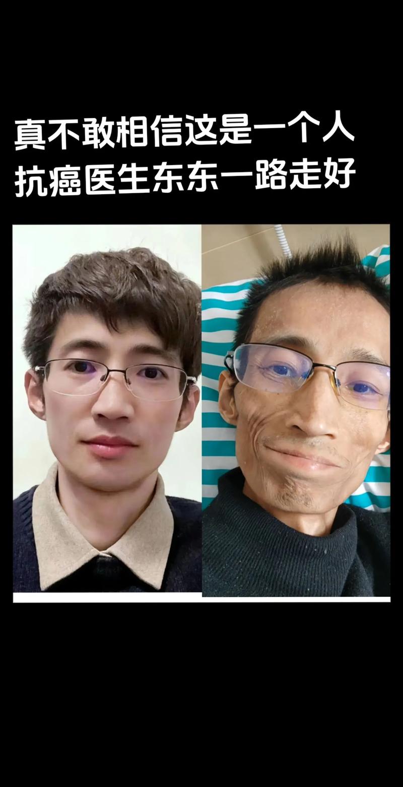  抗癌