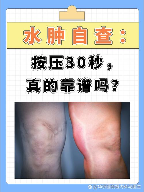 水肿现象