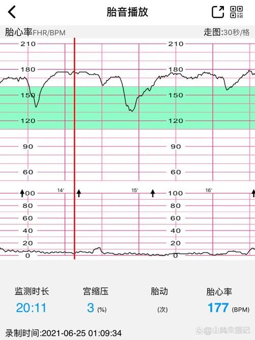 胎心率偏高