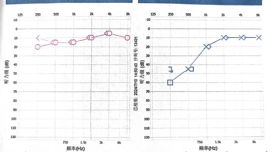 聋哑几率