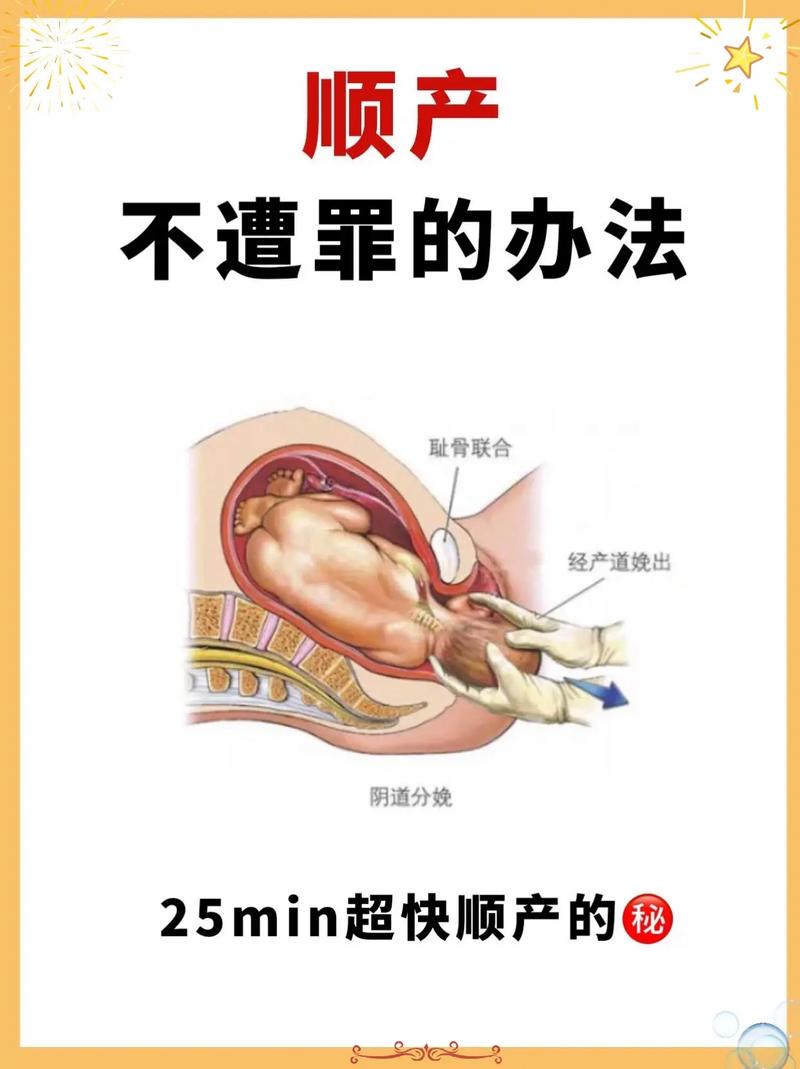 顺产可能性