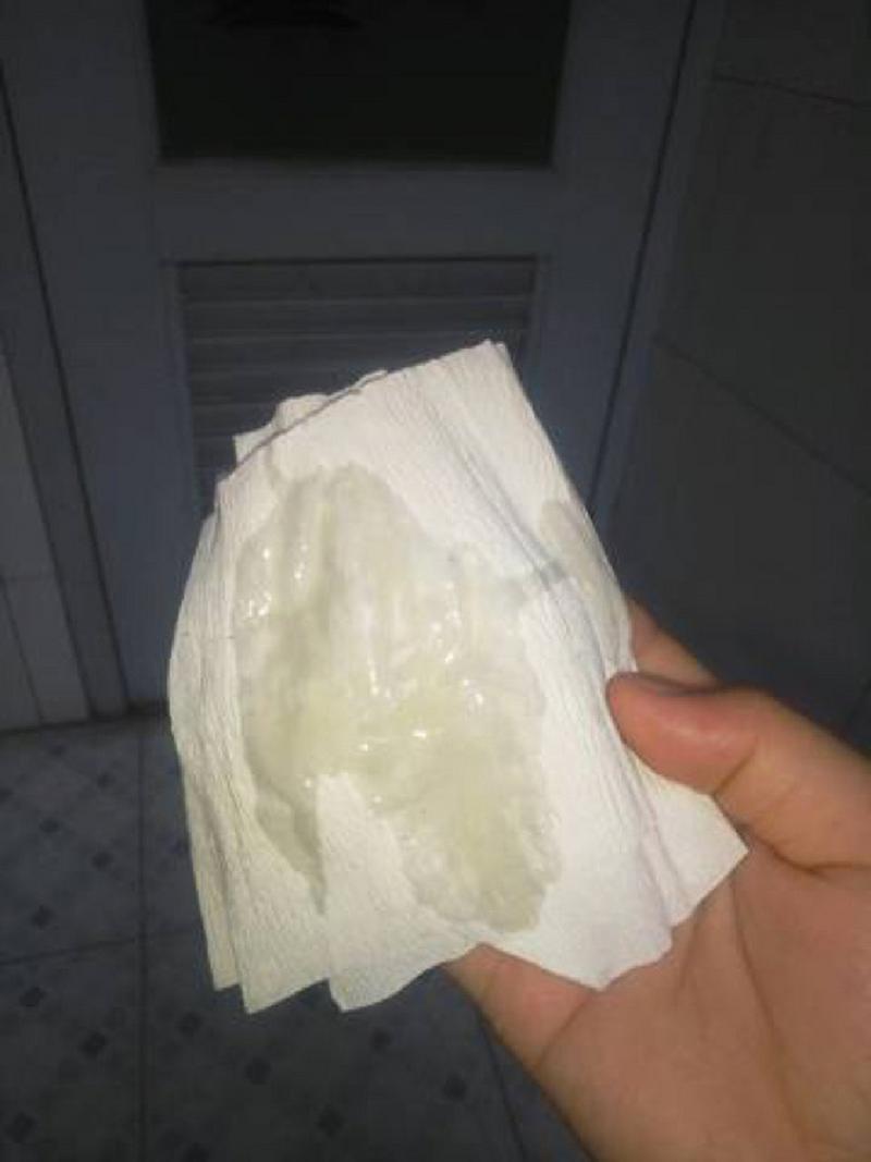 羊水破裂