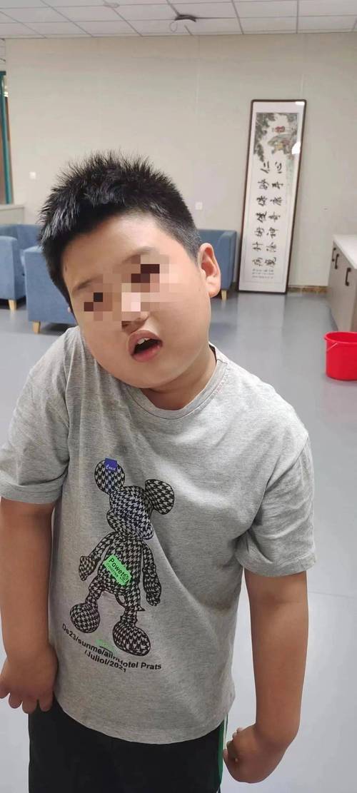 轻微歪斜